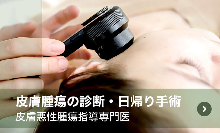 皮膚腫瘍の診断・日帰り手術|皮膚悪性腫瘍指導専門医